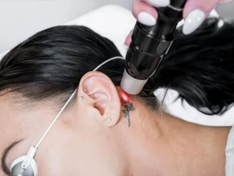 CME Webinar: Laser in Dermatologie und Ästhetik