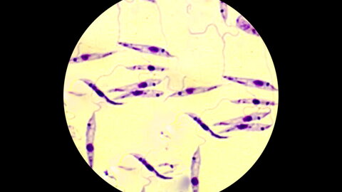 Promastigote der Lishmania-Arten unter dem Mikroskop