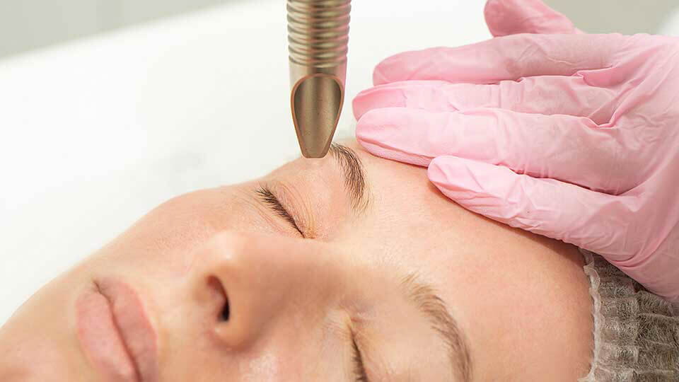 Gutartige Lidtumoren: CO₂-Laser statt Skalpell