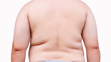 Der nackte Rücken eines übergewichtigen Mannes